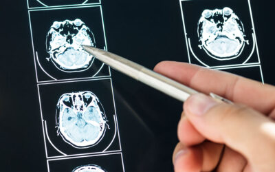 TBI: Traumatic Brain Injury