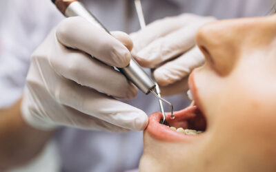 Medical negligence and Dentistry